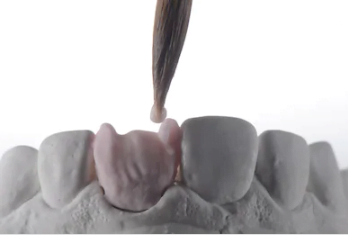 Aplicação-de-porcelana-em-dente
