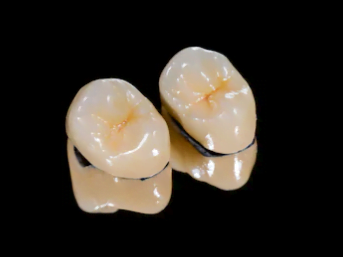 Dentes-de-porcelana
